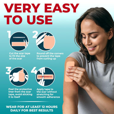 Medical Grade Silicone Scar Tape - 1.6 X150 - Visible Difference On Surgical & Keloid Scars - Reusable Silicone Scar Sheets - Easy To Use Silicone Tape For Scars