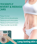 Silicone Scar Tape 1.6"X 60" Reusable Silicone Sheet For Scar Away Treatment Stretch Mark Removal Tattoo Cover Up Painless Scar Removal For Surgery, C Section, Acne, Keloid