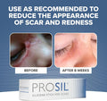 Prosil Silicone Scar Stick 4.25G Effective Scar Treatment With Premium-Grade Silicone Compact, Mess-Free, Glide-On Application For Convenient Scar Therapy Gentle On All Skin Types & Kids