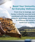 Manuka Honey Lozenges, Lemon Lozenges for Sore Throat Relief, 15 Honey Cough Drops (2.1 oz) ÃƒÂ¢Ã¢â€šÂ¬Ã¢â‚¬Å“ Dry Mouth Lozenges infused with Propolis & Echinacea, made with Raw Honey for Immune Support