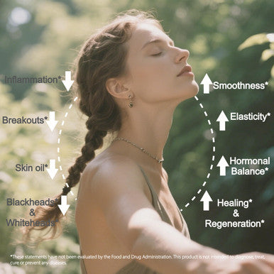 Life Space Acne Relief + Skin Rebalance Probiotic 6 In 1 Scientific Formula &