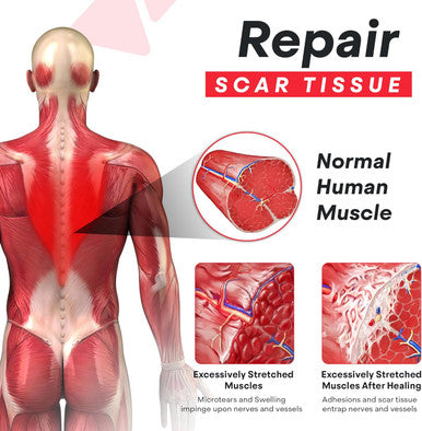Psoas Muscle Release Tool - Deep Tissue Massager, Stretcher And Acupressure Reflexology For Back Pain, Scar Tissue Adhesion, Trigger Point Piriformis Syndrome & Sciatica Relief