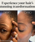 Biotin Hair Growth Serum by Pureauty Naturals - Advanced Topical Formula to Help Grow Healthy, Strong Hair - Suitable For Men & Women Of All Hair Types - Hair Loss Support