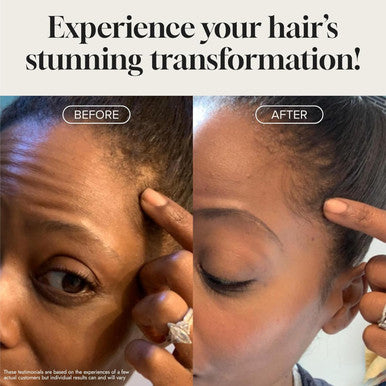Biotin Hair Growth Serum by Pureauty Naturals - Advanced Topical Formula to Help Grow Healthy, Strong Hair - Suitable For Men & Women Of All Hair Types - Hair Loss Support