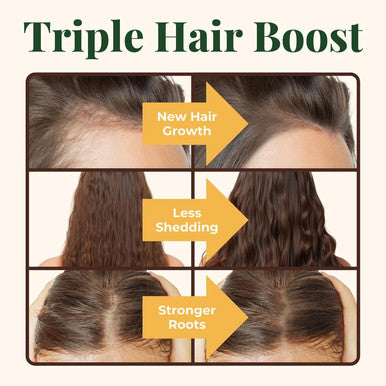 Heebin'S Hair Growth Supplements With Biotin 4000 Mcg, Dht Blocker And Collagen, For Hair Loss, Thinning And Regrowth, 60 Tablets, 2 Month Supply