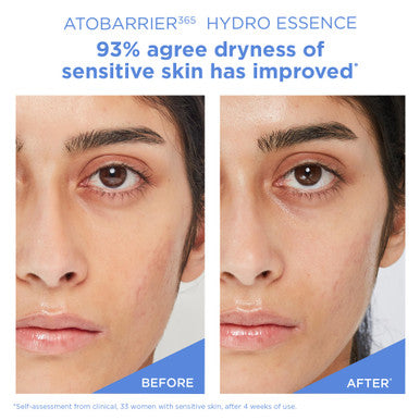 AESTURA ATOBARRIER365 Hydro Essence with Hydrating Amino Acids for Face | Lightweight Formula Deep Hydration Suitable for Dry & Sensitive Skin Non-Comedogenic 100ML / 3.38 fl. oz.
