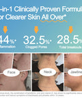 Life Space Acne Relief + Skin Rebalance Probiotic 6 In 1 Scientific Formula &