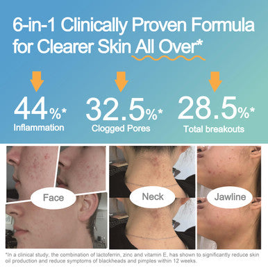 Life Space Acne Relief + Skin Rebalance Probiotic 6 In 1 Scientific Formula &
