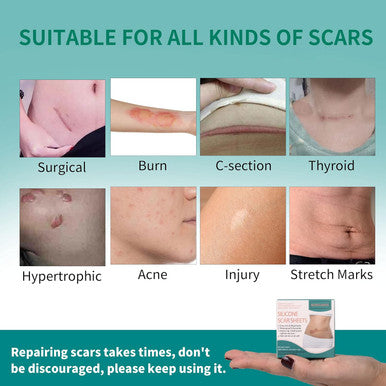 Silicone Scar Tape 1.6"X 60" Reusable Silicone Sheet For Scar Away Treatment Stretch Mark Removal Tattoo Cover Up Painless Scar Removal For Surgery, C Section, Acne, Keloid
