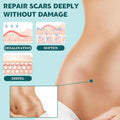 Silicone Scar Sheets,(1.6" X 60" Roll-1.5M) Silicone Scar Tape For Surgical Scars,Silicone Scar Removal Strips For Surgical,C-Section,Tummy Tuck,Keloid Scars Keloid Bump Removal