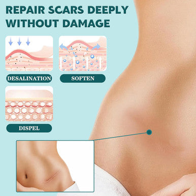 Silicone Scar Sheets,(1.6" X 60" Roll-1.5M) Silicone Scar Tape For Surgical Scars,Silicone Scar Removal Strips For Surgical,C-Section,Tummy Tuck,Keloid Scars Keloid Bump Removal