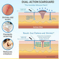 Invisible Brush-On Silicone Sheet With Vitamin E - Scar Removal For Keloids, Burn Scars, Surgery Scars, Stitches, Cuts - No Ugly Scar Sheets, Cream Or Messy Scar Gel Needed