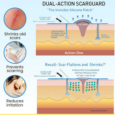 Invisible Brush-On Silicone Sheet With Vitamin E - Scar Removal For Keloids, Burn Scars, Surgery Scars, Stitches, Cuts - No Ugly Scar Sheets, Cream Or Messy Scar Gel Needed