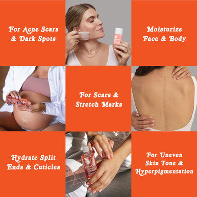 Bio-Oil Skincare Body Oil Vitamin E Serum For Scars & Stretchmarks Face & Body Moisturizer 2 Oz All Skin Types (Pack Of 24)