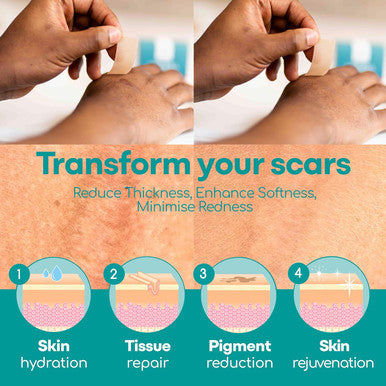 Medi Grade Silicone Scar Sheets, 80 Inches Long - Reusable Silicone Scar Tape For C-Section, Keloid, Burn, Acne And Surgical Scars - Silicone Scar Strips - Includes Hygienic Storage Case/Sheet