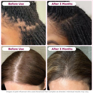 Nature's Bounty Optimal Solutions Hair Growth 30 Capsules