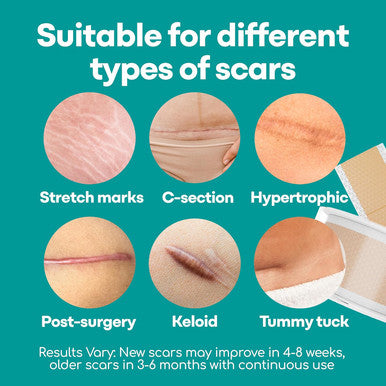 Medi Grade Silicone Scar Sheets, 80 Inches Long - Reusable Silicone Scar Tape For C-Section, Keloid, Burn, Acne And Surgical Scars - Silicone Scar Strips - Includes Hygienic Storage Case/Sheet