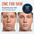 Zinc Supplement Microbeadlets For Immune & Acne Support Highly Absorbable Zinc Bisglycinate & Orotate With 2Mg Chelated Copper + Vitamin B6 Vegan, Gluten- 60 Capsules (2 Month Supply)