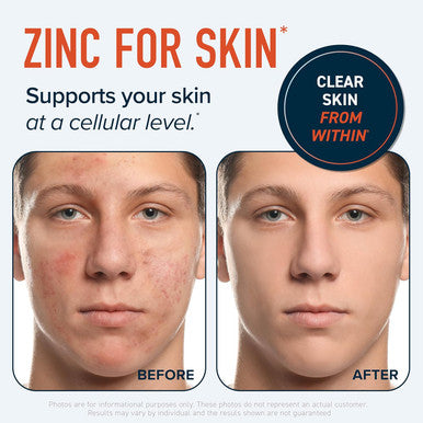 Zinc Supplement Microbeadlets For Immune & Acne Support Highly Absorbable Zinc Bisglycinate & Orotate With 2Mg Chelated Copper + Vitamin B6 Vegan, Gluten- 60 Capsules (2 Month Supply)