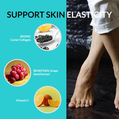 Upnourish Vein Health Supplement, Cellulite Support And Leg Circulation Booster With Caviar Collagen, Sod, Morosil, Butchers Broom, Horse Chesnut 90Ct