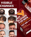 Dht Blocker For Men Hair Growth Supplement With Saw Palmetto & Biotin - Hair Growth Vitamins - Hair Regrowth - Natural Hair Loss Supplements Liquid-Filled - Proprietary Herbal Blends (90 Capsules)