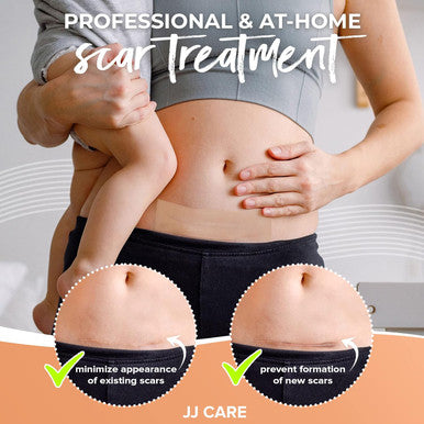 Jj Care Soft Silicone Tape, 1.6 X 120 Flexible Silicone Scar Tape, Medical Grade Silicone Strips For Scars, Washable & Reusable Scar Tape For Surgical Scars, Latex-Scar Tape
