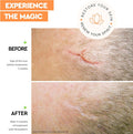 Strataderm Professional Scar Therapy Gel Old And Scars From General Surgery, Trauma, Wounds, Burns, Bites, Acne & Skin Disease Reduces Redness, Discoloration, Discomfort & Itch 5G (0.17Oz)