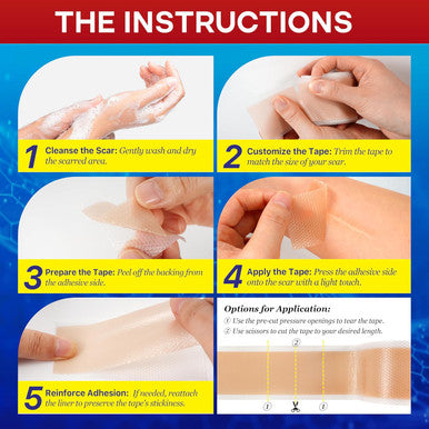 Medical Silicone Scar Tape For Scars: Medical Grade Scar Sheets Reduces The Appearance Of Scars From Surgical Acne Stitches Burns More 1.6"X 120"