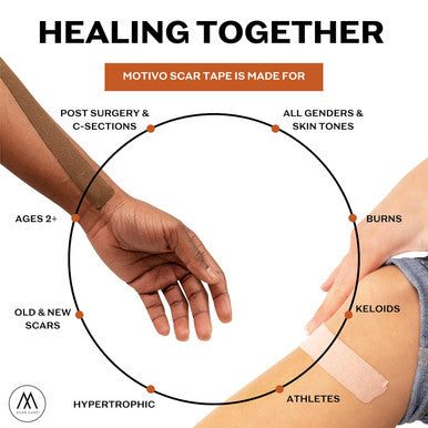Motivo Scar Tape - 200 X1 Roll (20 Strips) Water And Sweat Resistant Scar Tape, Latex-Free, Sticks For 3-5 Days Scar Tape For Surgical Scars, C Section, Burns, Gender Affirming Surgery - Espresso