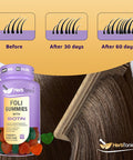 Herbtonics Foli Gummies Biotin Gummies With Hair Vitamins Hair Growth Supplement For Women & Men Hair, Skin And Nails Vitamins Gummies For Women Vitamins For Hair Growth 60 SugarGummies