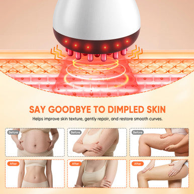 Multford Rechargeable Lymphatic Drainage Massager & Cellulite Massage Tool With 3000MahFascia Blaster For Reduce Stretch Marks For Legs Arms & BellyBody Sculpting Machine With Microcurrent For Office Travel