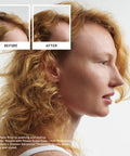 Nioxin System 1 Scalp + Hair Thickening Shampoo | For Natural Hair with Light Thinning | Hair Care Formula with Niacinamide & Biotin