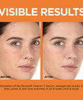 L'Oreal Paris Revitalift 12% Pure Vitamin C Serum Vitamin E Salicylic Acid Brightening 1 Oz + Moisturizer Sample