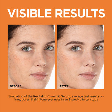 L'Oreal Paris Revitalift 12% Pure Vitamin C Serum Vitamin E Salicylic Acid Brightening 1 Oz + Moisturizer Sample