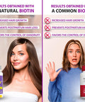 Biotin Hair Skin And Nails Vitamins, Vitamin C, Biotin And Collagen Supplements That Make Hair Grow Faster And Longer, For All Ages, 60 Capsules Of Biotin 20000Mcg Maximum Strength.