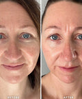 Alpha H Vitamin E Serum with 1% Ceramide Complex