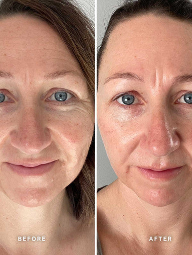 Alpha H Vitamin E Serum with 1% Ceramide Complex 15ml