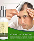 Natural Hair Growth Oil with Caffeine and Biotin - Hair Growth Oil for Stronger, Thicker, Longer Hair 1.7 oz