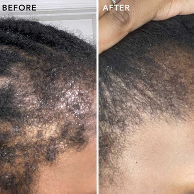 Sunday II Sunday Hair Flourish Biotin Infused Serum